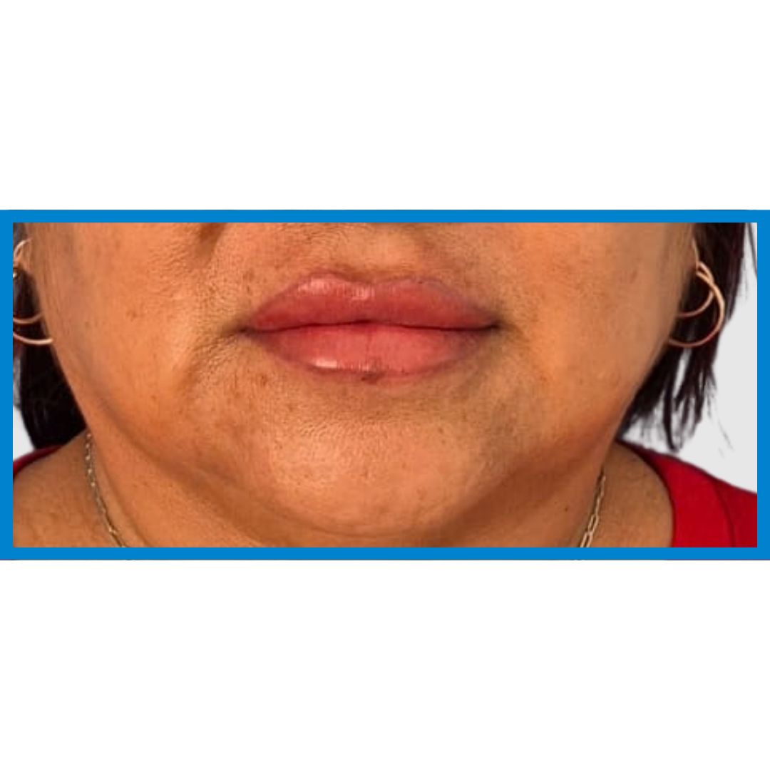 After-Labios