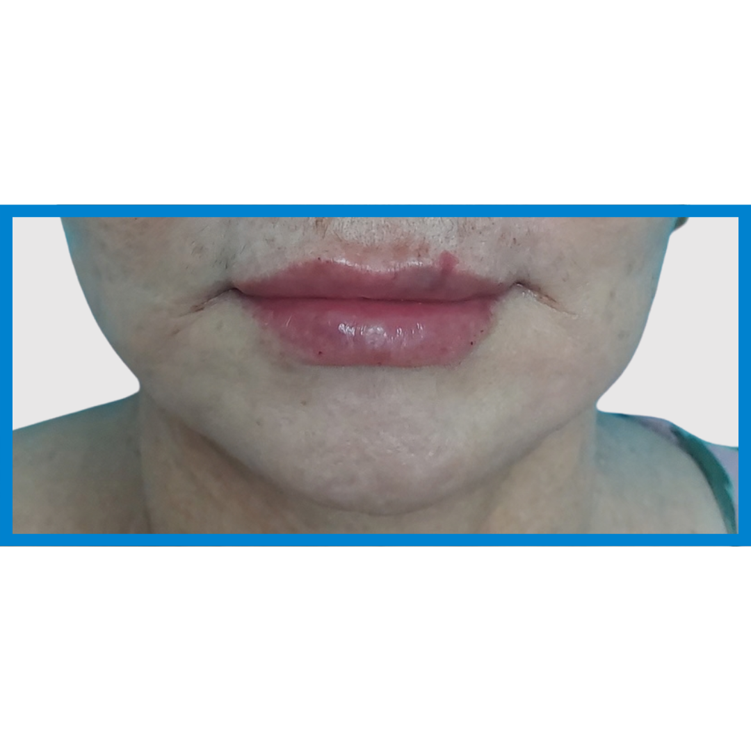 After-Labios