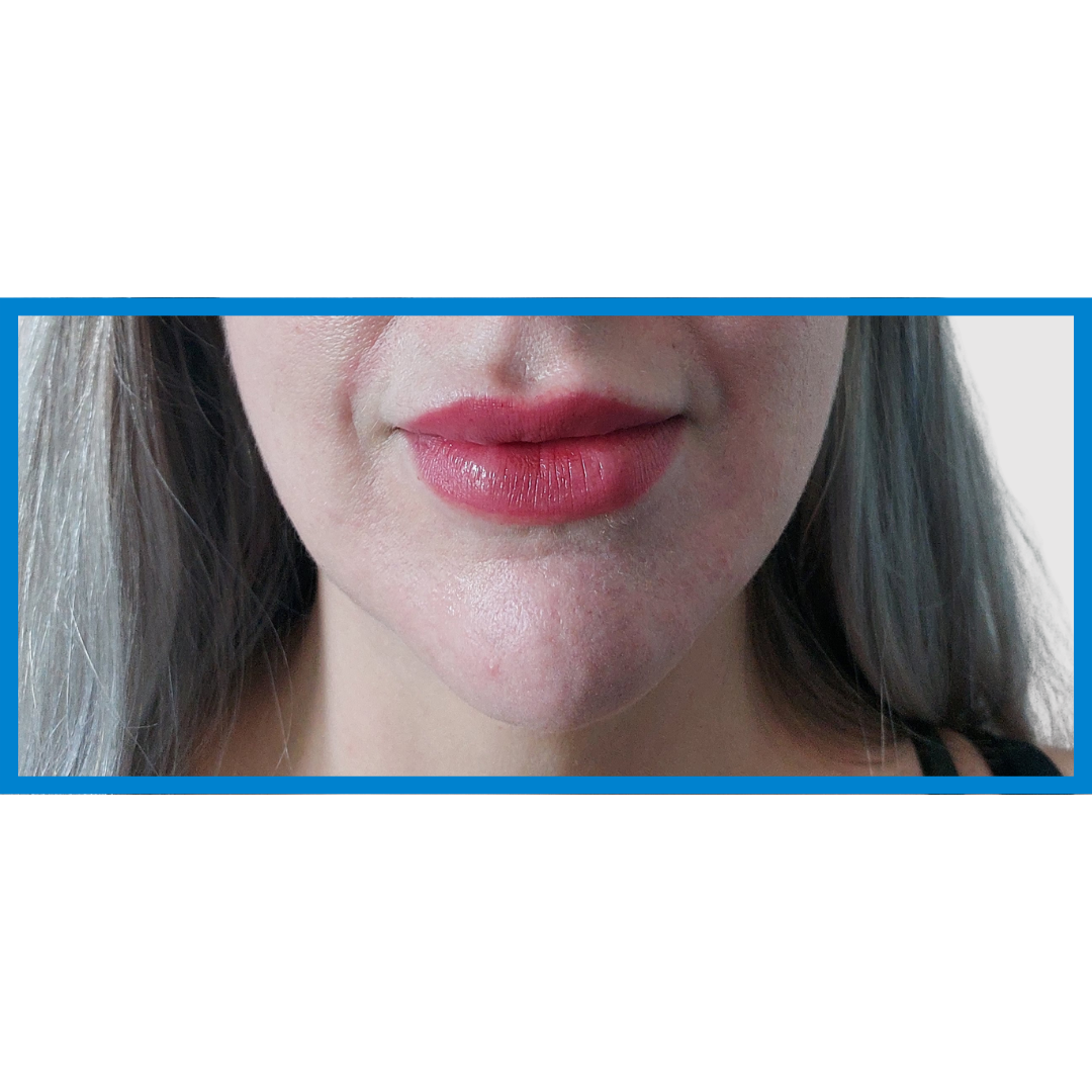 After-Labios