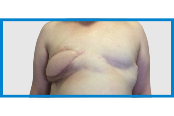 443